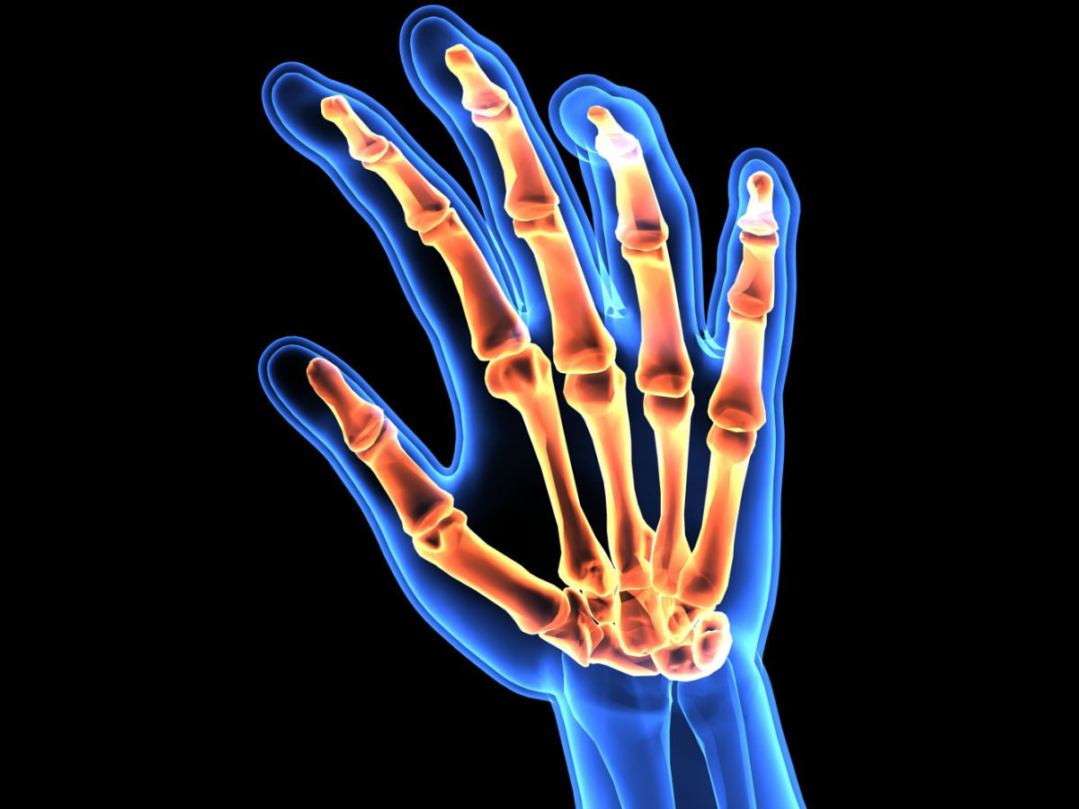 RA What Is Rheumatoid Arthritis And How It Will Affect Your Life