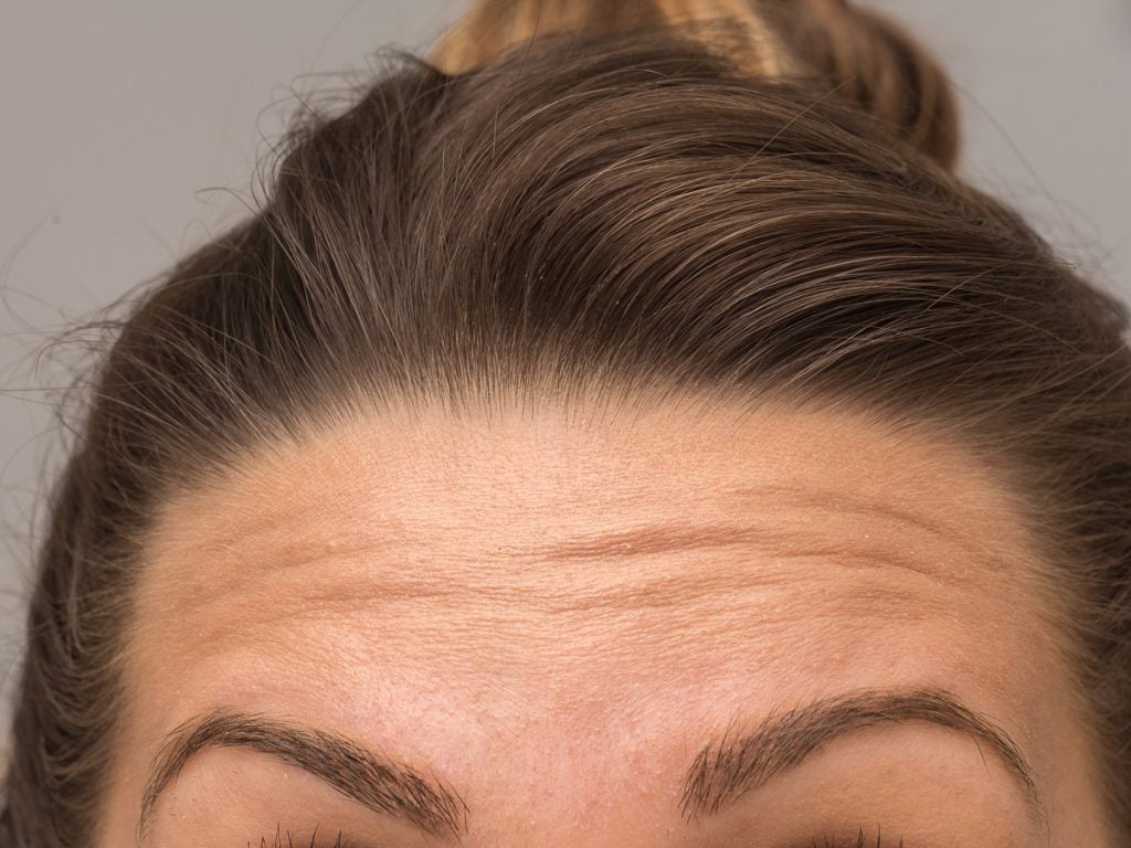 what-your-facial-wrinkles-may-be-trying-to-tell-you-best-health