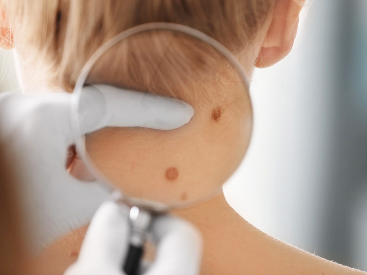 Lumps and Bumps on Skin Explained | Best Health Canada