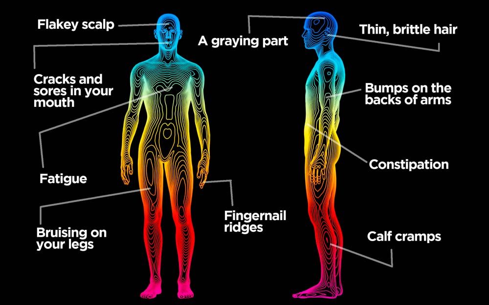 Signs of Vitamin Deficiencies Best Health Canada