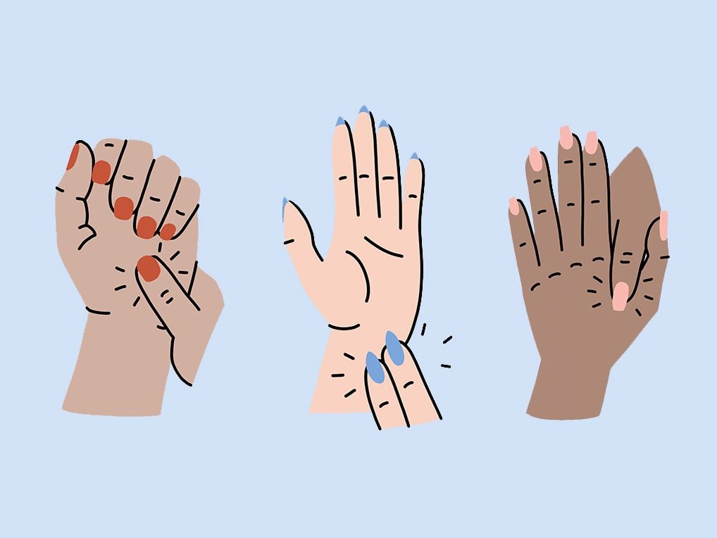 3 Hand Pressure Points for Stress, Sleep and Headaches | Best Health Canada