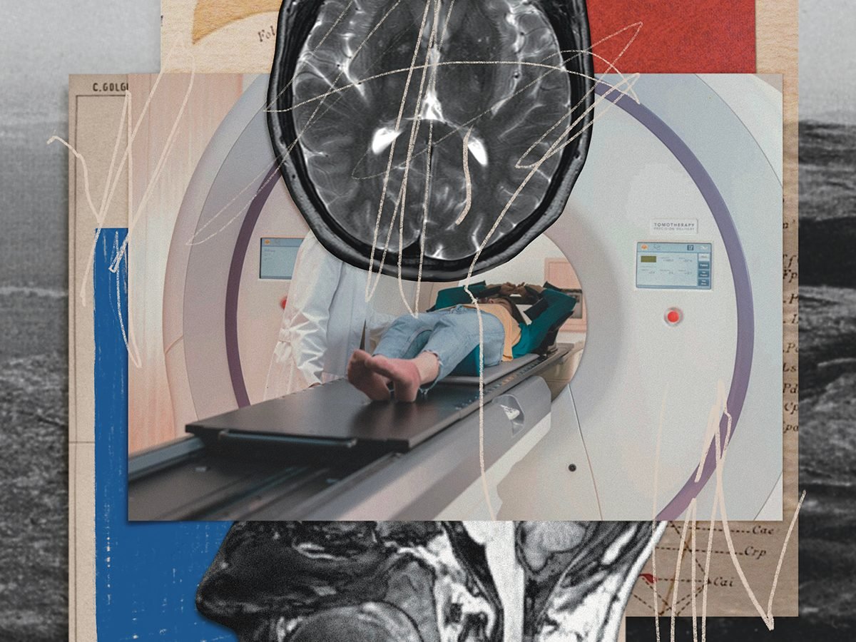 Are Whole-Body MRI Scans Too Good to Be True?