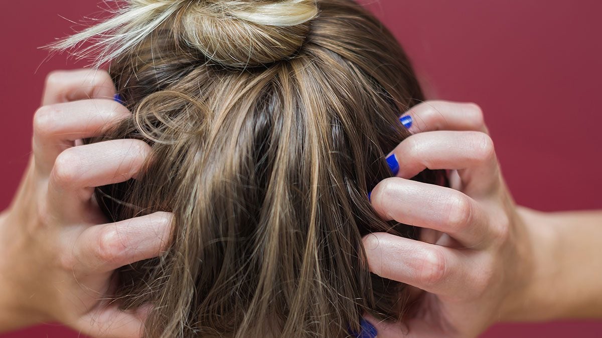 Is Itchy Scalp Linked To Hair Loss A Look At The Evidence