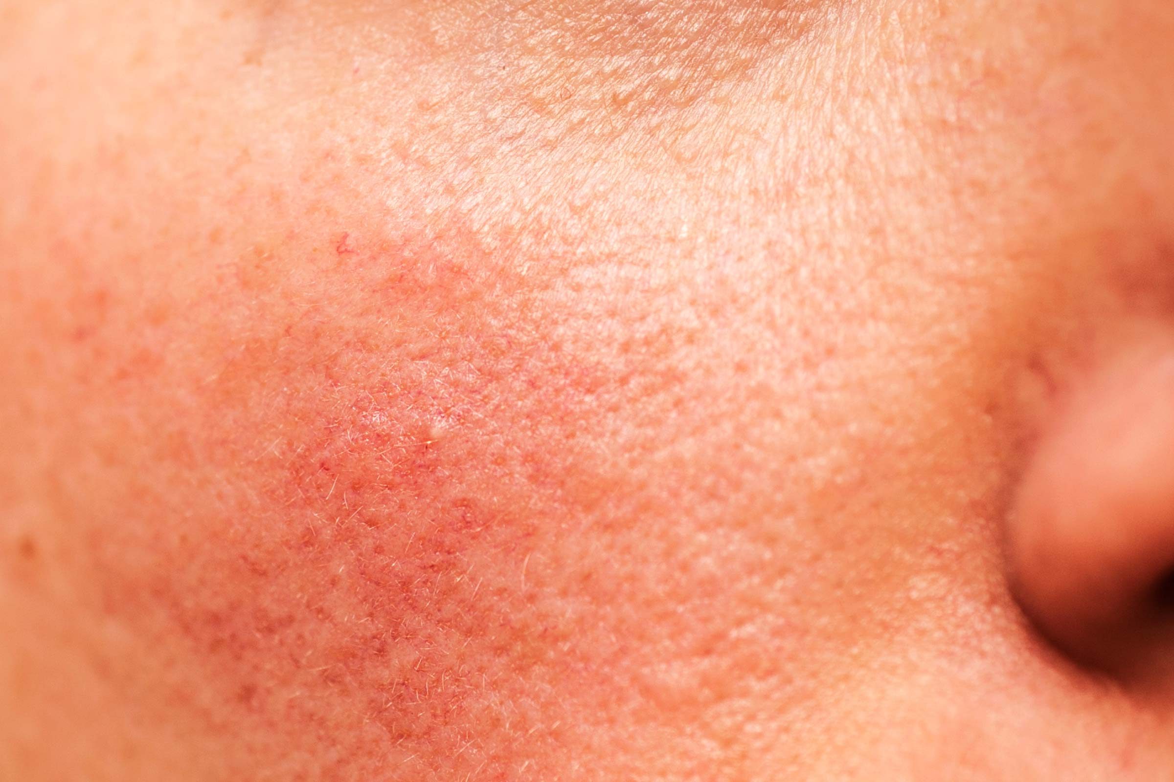 Skin Disease Signs Of Disease Your Skin Can Reveal Best Health