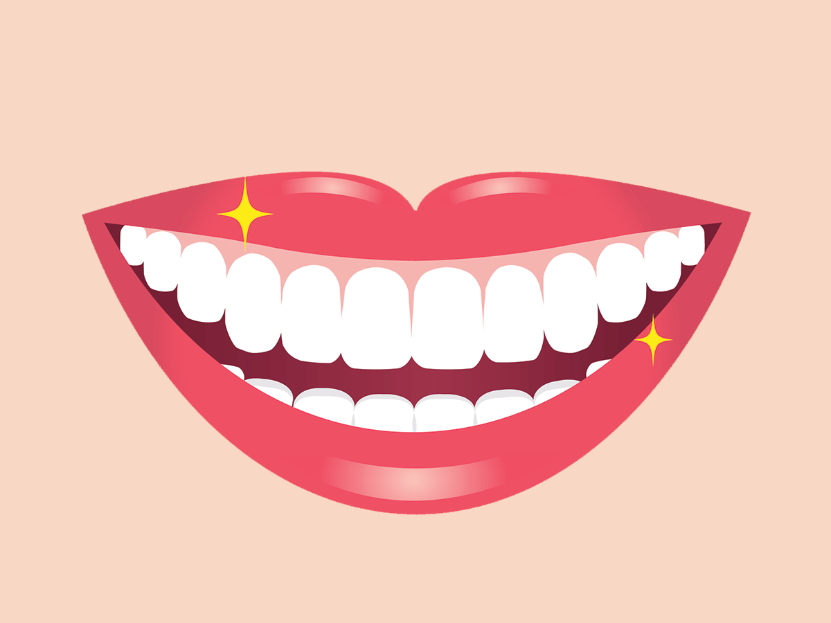 Can you use teeth whitening products on veneers